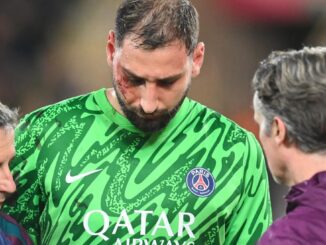 Donnarumma fit for French Super Cup after bad face injury – The Headlines