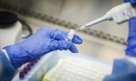 Africa’s only anti-doping lab has status revoked by WADA for testing flaws – The Headlines